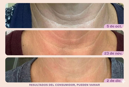 Dermapure- Crema Reafirmante para Cuello y Escote